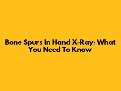 Bone Spurs In Hand X-Ray: What You Need To Know
