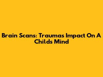 Brain Scans: Trauma's Impact On A Child's Mind