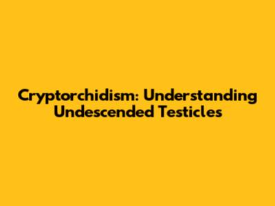 Cryptorchidism: Understanding Undescended Testicles