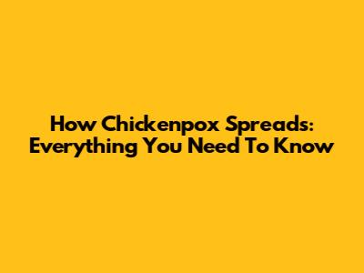 How Chickenpox Spreads: Everything You Need To Know
