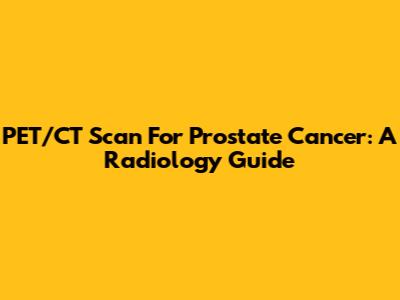 PET/CT Scan For Prostate Cancer: A Radiology Guide