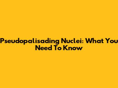 Pseudopalisading Nuclei: What You Need To Know