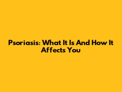 Psoriasis: What It Is And How It Affects You